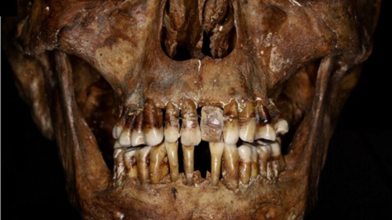 This 17th-Century Aristocrat Had an Ingenious Secret For Keeping Her Teeth