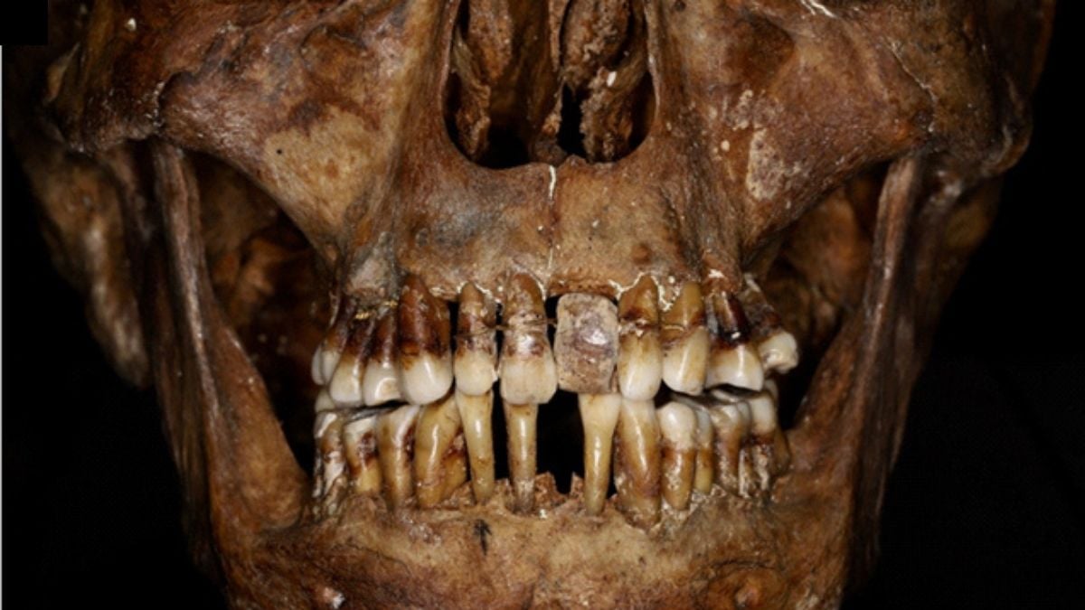 This 17th-Century Aristocrat Had an Ingenious Secret For Keeping Her Teeth