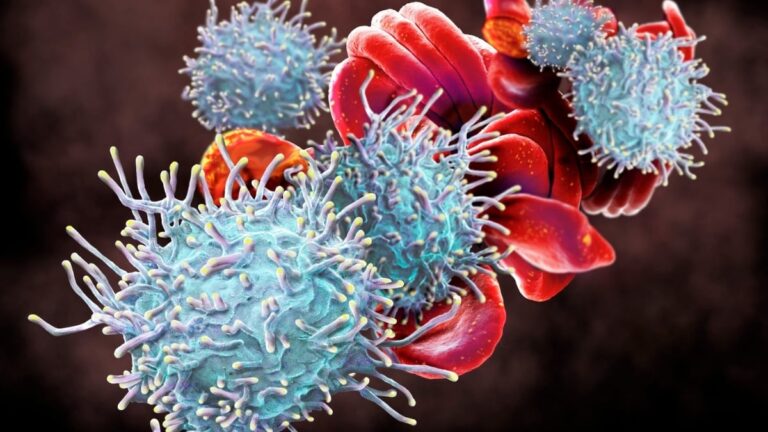 Doctors Found 4 Autoimmune Diseases in One Woman at One Time