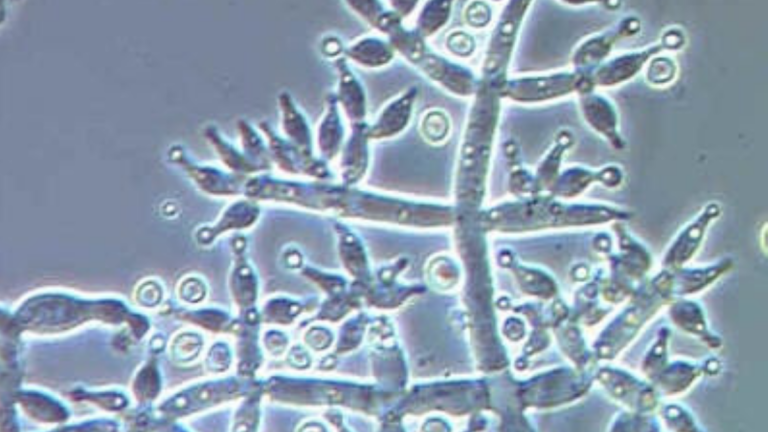 Test Yourself: This Week's Microscope Mystery