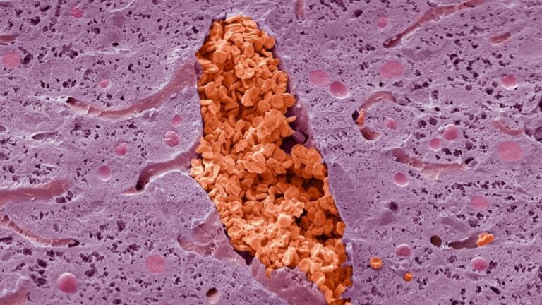 Monday's Microscope Mystery: What Is This Pink And Red Oddity?