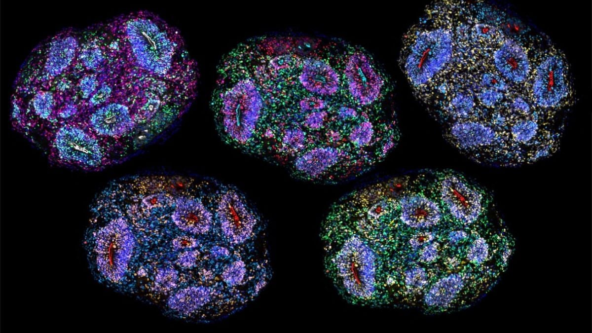 Unprecedented: Scientists Have Built Miniature Brains That Experience The Passage Of Time
