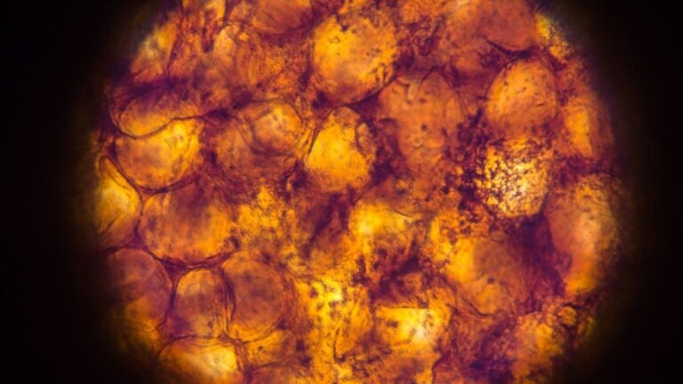 Our Fat Tissue May 'Remember' Obesity, Even After We've Lost Weight