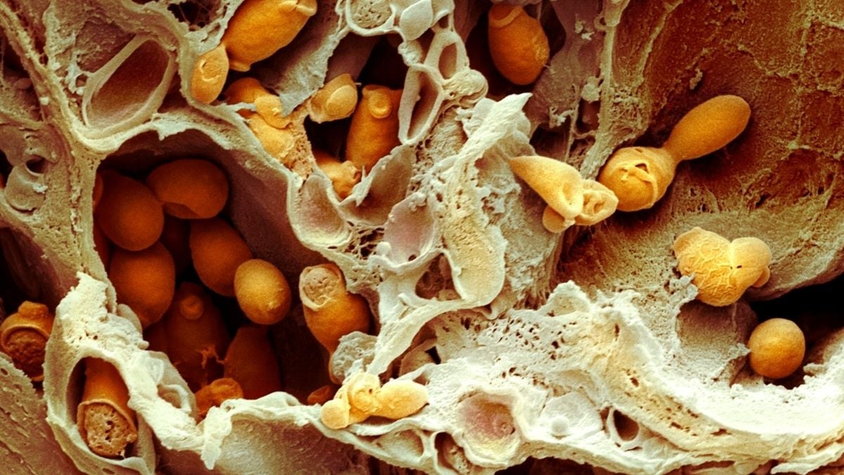 Deadly, Drug-Resistant Fungal Infections Are Spreading – Scientists Just Discovered a Potential Treatment