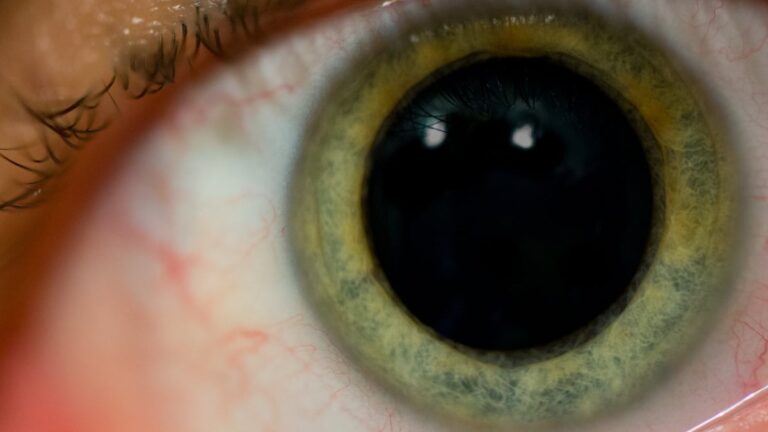 Scientists Reveal The Strange Neurological Reason Your Pupils Dilate When You're Surprised