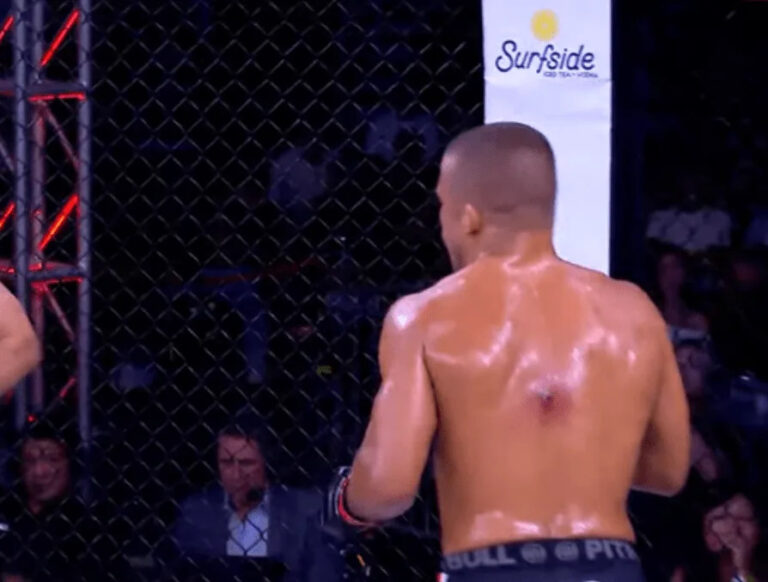 Fans React To ‘Disgusting’ Staph Infection, Slam CSAC For Approving Fight