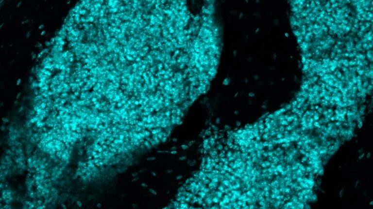Scientists Discover a New Organ Hiding in The Skull