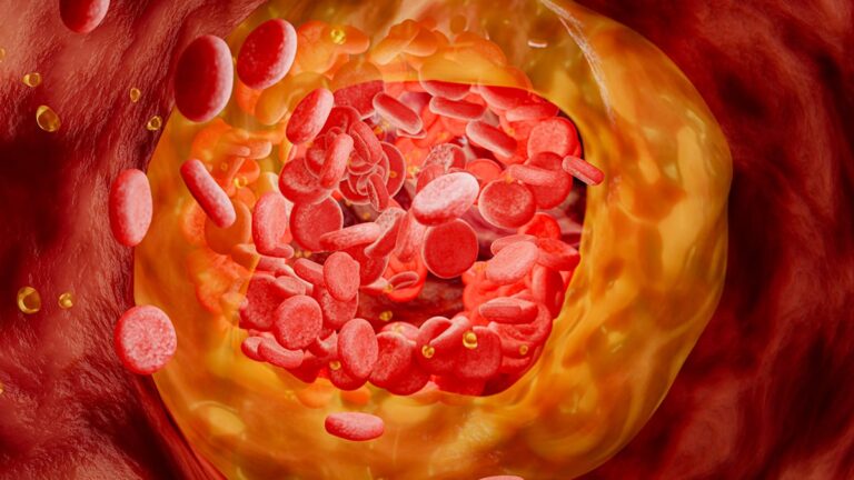 Experimental One-Dose Treatment Cuts 'Bad' Cholesterol by 52% in First Human Trial