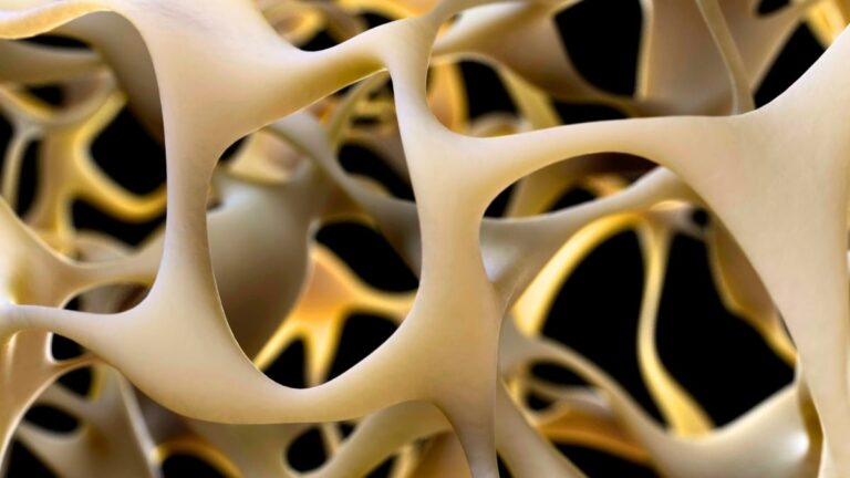 'Living Medication' May Have Restored Bone Strength in 10 Patients With Advanced Osteoporosis