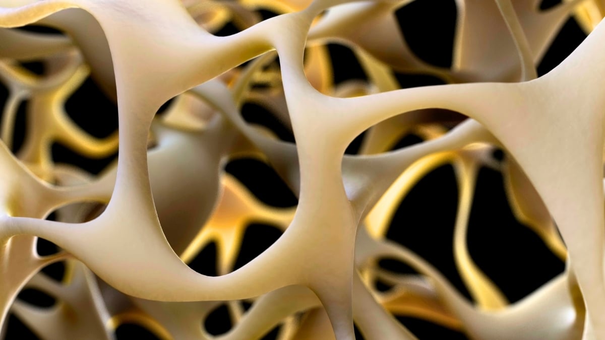 'Living Medication' May Have Restored Bone Strength in 10 Patients With Advanced Osteoporosis