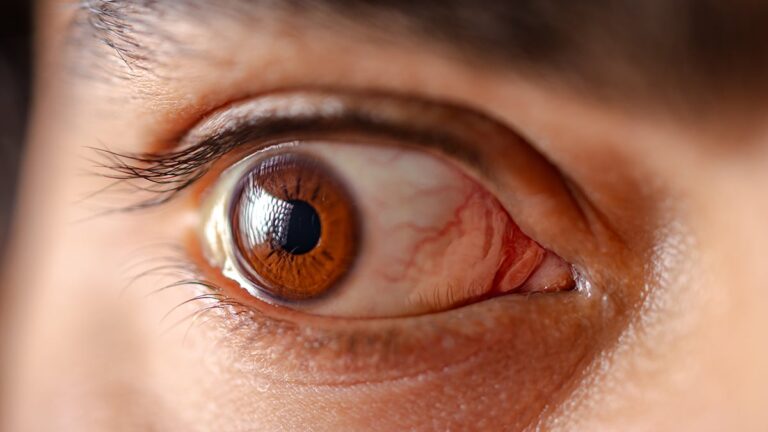 China Just Let AI Run an Eye Clinic. Here's What Happened.